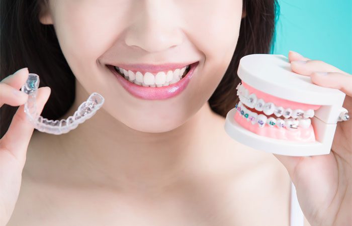 invisalign-hacks:-10-tips-to-make-your-treatment-easier